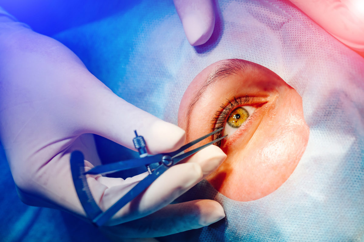 chirurgie-paupiere